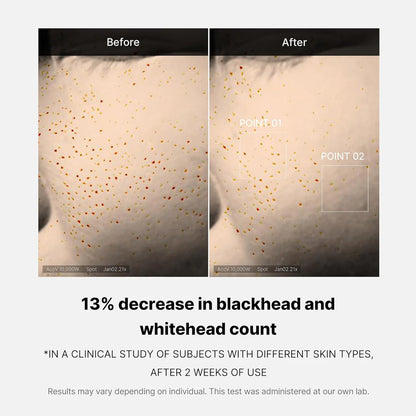 Medicube Zero Pore One Day Serum – 30ml