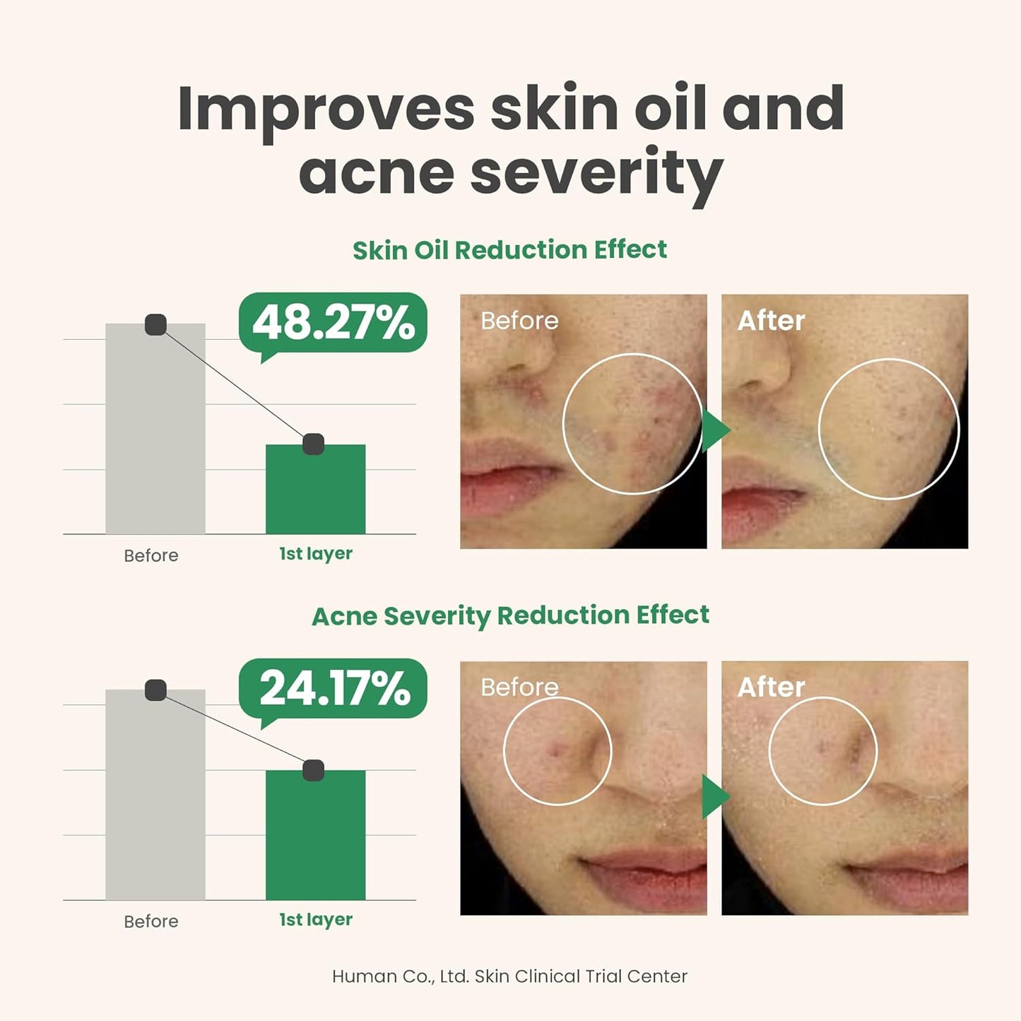 AXIS-Y Spot The Difference Blemish Treatment | 15ml