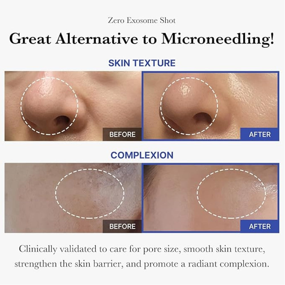 Medicube One Day Exosome Shot Pore Ampoule 2000 – 30ml