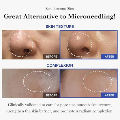 Medicube One Day Exosome Shot Pore Ampoule 2000 – 30ml