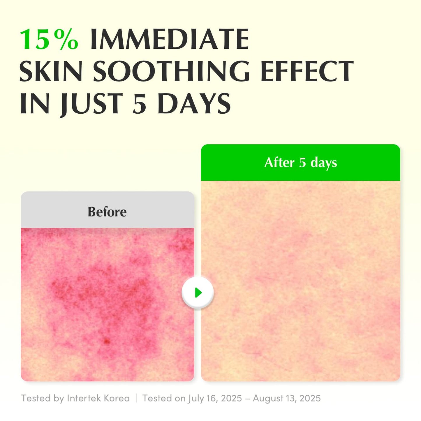 Eqqualberry Aloe PDRN Calming Smoothie Serum – Soothing & Repairing 30ml