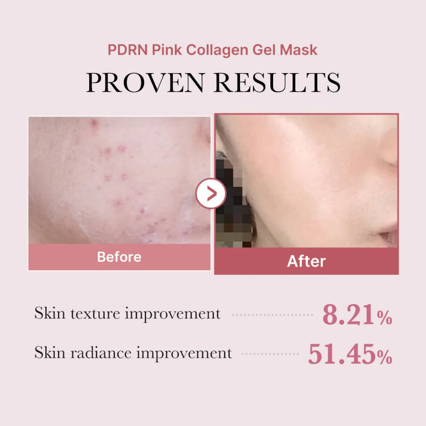 Medicube PDRN Pink Collagen Jelly Gel Mask 28g