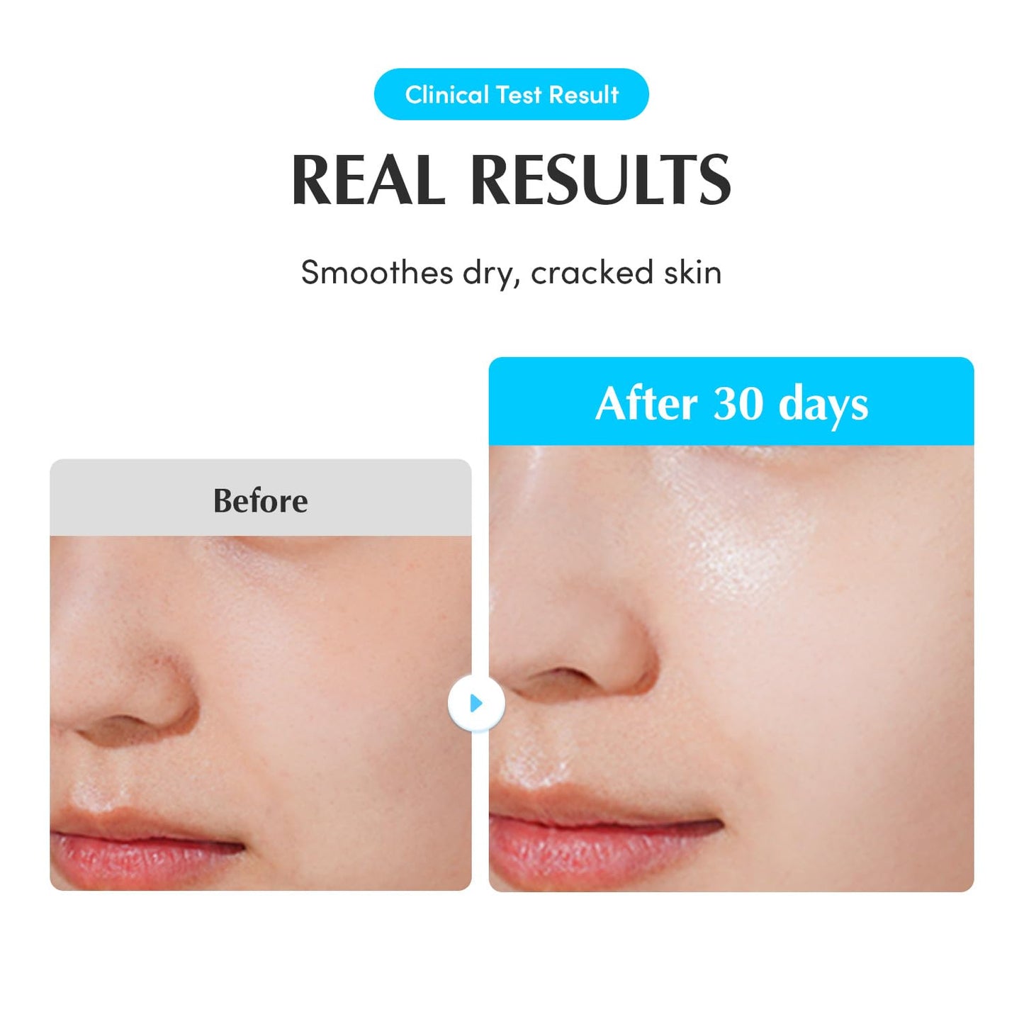 Eqqualberry Swimming Pool Deep Hydration Set – Ultimate Moisture & Glow Duo