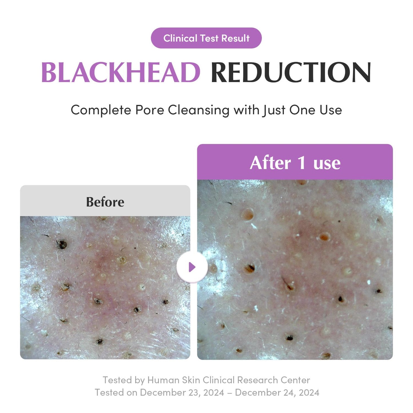 Eqqualberry Purple Rice Pore Purifying Pack Cleanser–120ml