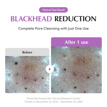 Eqqualberry Purple Rice Pore Purifying Pack Cleanser–120ml