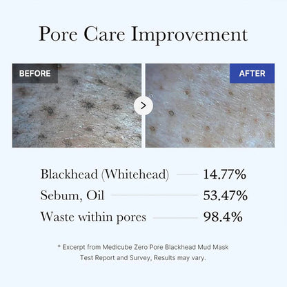 Medicube Zero Pore Blackhead Mud Facial Mask | 100ml