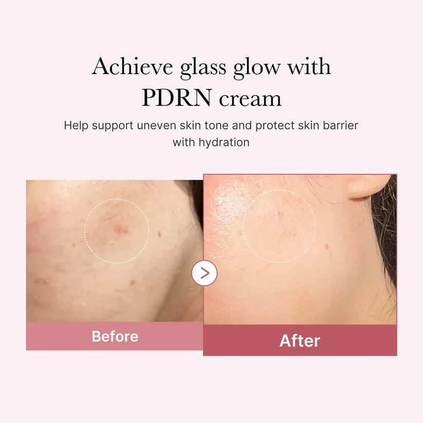 Medicube PDRN Pink Hyaluronic Moisturizing Cream | 50ml