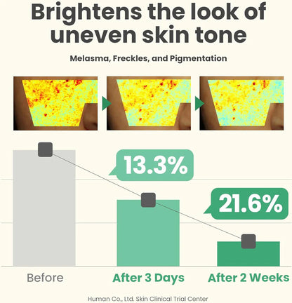 AXIS-Y Dark Spot Correcting Glow Serum – Brighten, Fade, Glow | 50ml