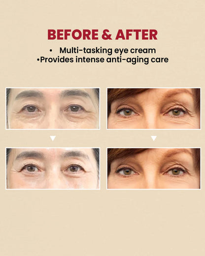 KSECRET SEOUL 1988 Eye Cream – Retinal Liposome 4% + Fermented Bean | 30ml