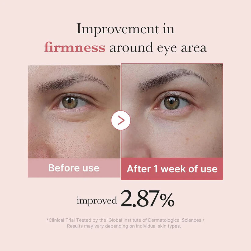 Medicube PDRN Pink Peptide Eye Serum | 30ml